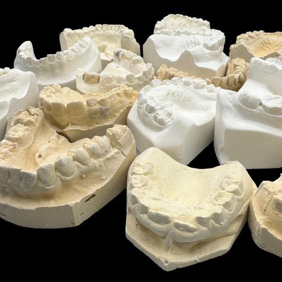 Vintage Plaster Dental Mold - Teeth Tooth Mold - Creepy Oddity - Dental Oddities - Picture 3 of 16